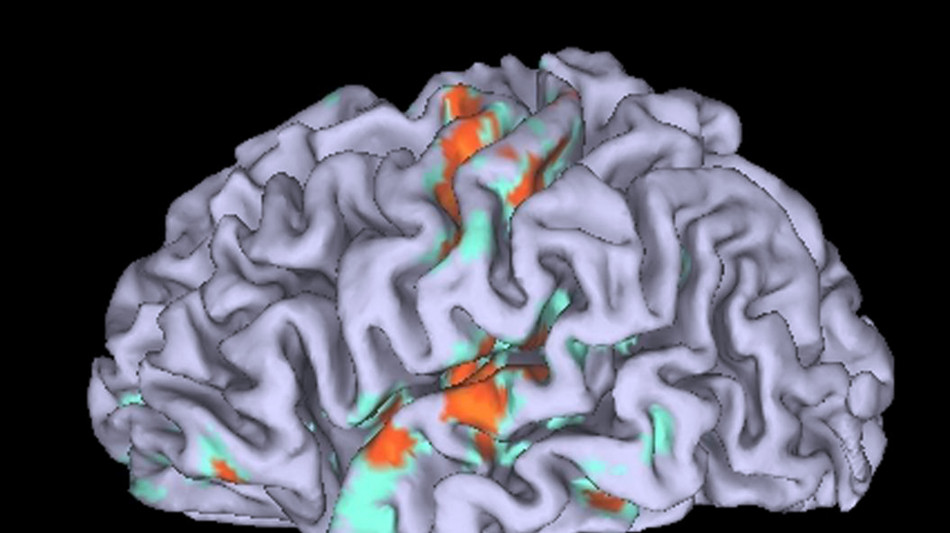 Il cervello non invecchia tutto insieme, c'è un punto caldo