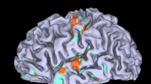 Il cervello non invecchia tutto insieme, c'è un punto caldo