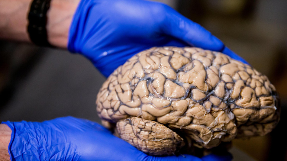 Uno zoom mostra il cervello umano come mai visto prima