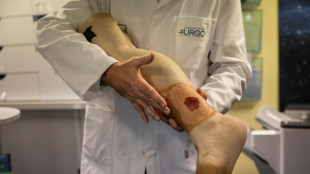 Dressing 'revolution' seeks artificial skin for burn victims