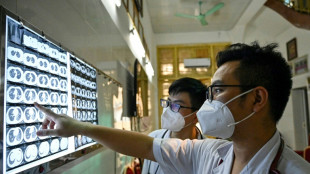 Tuberculosis cases hit record high: WHO